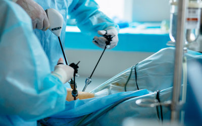 Laparoscopic TAPP Inguinal Hernia Repair