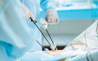 Laparoscopic Appendectomies