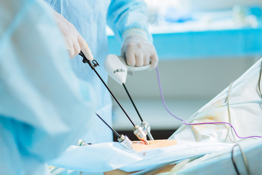Laparoscopic Appendectomies
