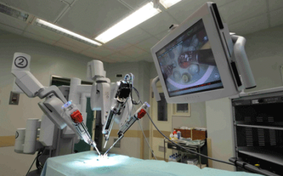 Robotic Colectomies