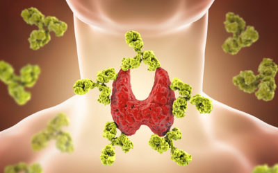 Thyroidectomies