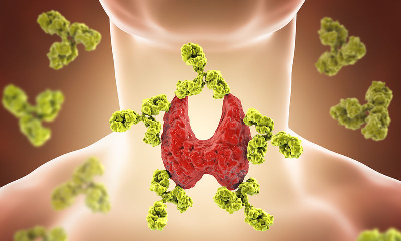 Thyroidectomies