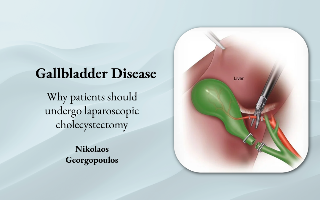 Gallbladder Disease – Why patients should undergo laparoscopic cholecystectomy