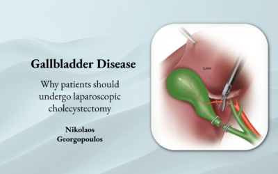 Gallbladder Disease – Why patients should undergo laparoscopic cholecystectomy