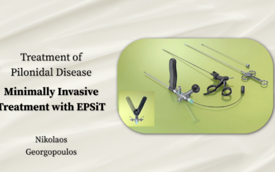 Endoscopic Treatment of Pilonidal Disease  – Minimally Invasive Treatment with EPSiT